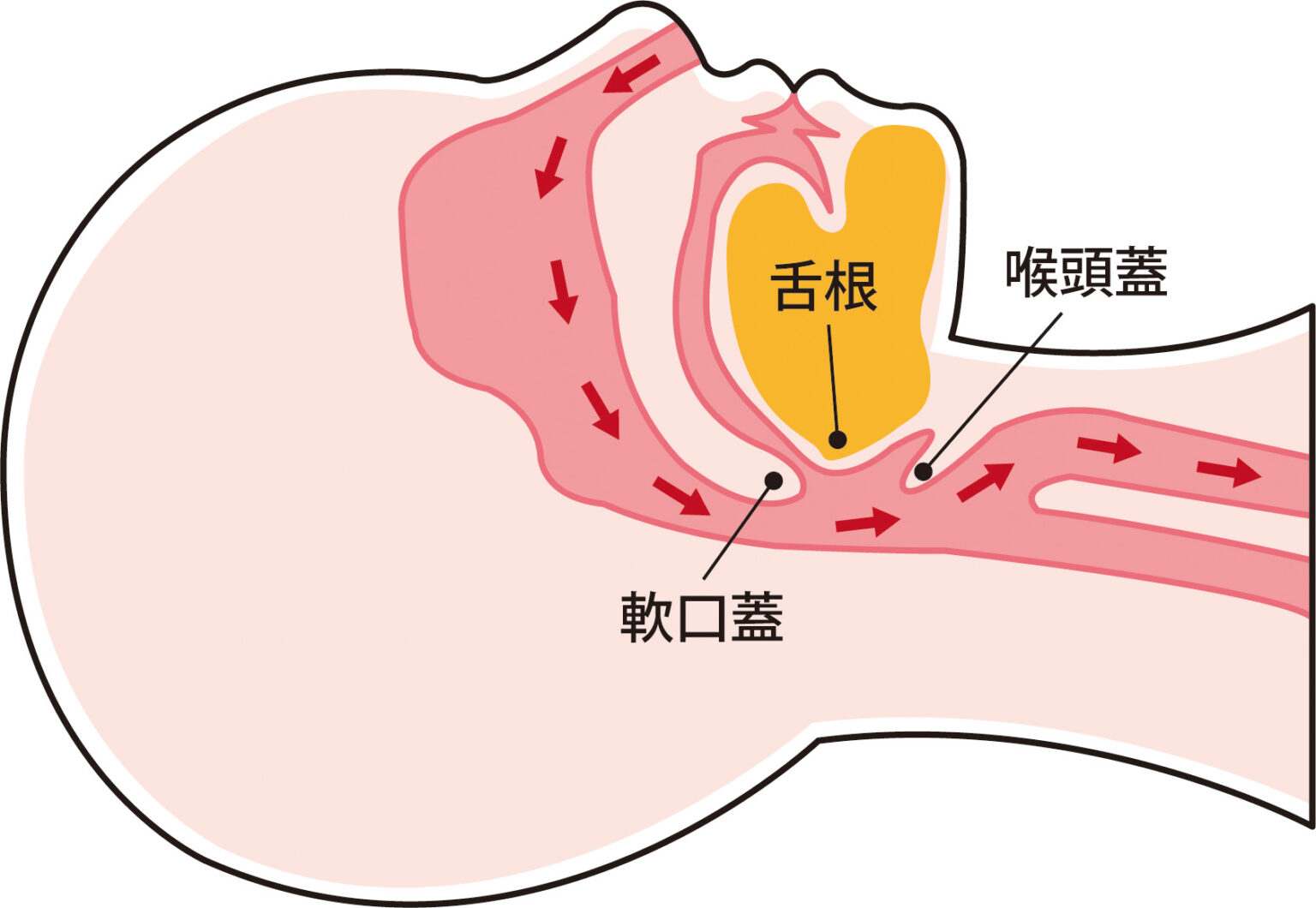 睡眠時無呼吸症候群とは何ですか?